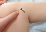 小腿水腫是什么原因引起的？教你輕松解決之道