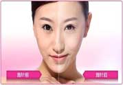 美白針真的有效嗎？美白針的危害有哪些？
