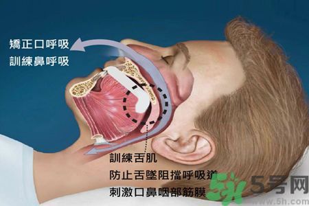 耳鳴是什么原因引起的？耳鳴怎么治療最好？