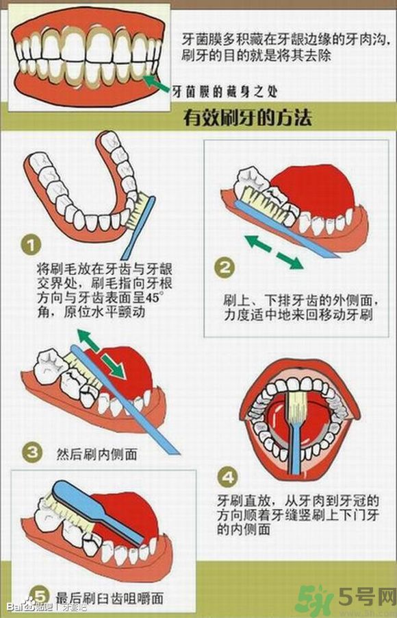 18歲還能戴牙套嗎？戴牙套真的能瘦臉改變臉型嗎？