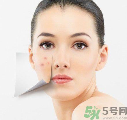 臉上有斑怎么去除？祛斑的小偏方有哪些？