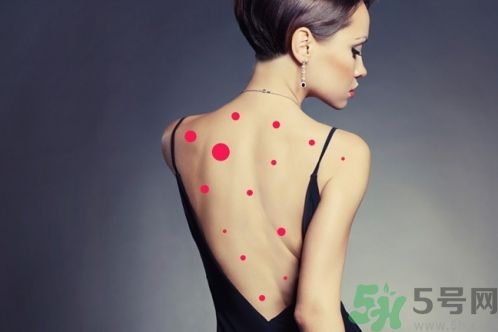 背上為什么會長痘痘？長痘痘怎么辦？