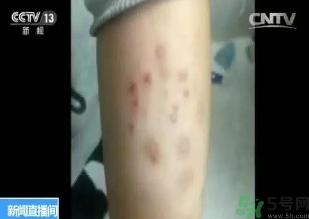 被污染學(xué)校是哪個？500師生患病的原因？