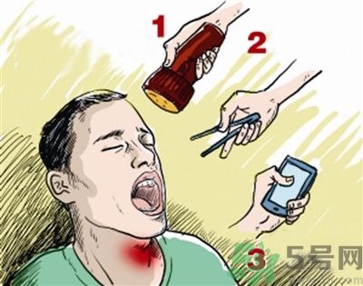 魚(yú)刺卡喉喝醋可以治療嗎？魚(yú)刺卡喉喝醋好不好？