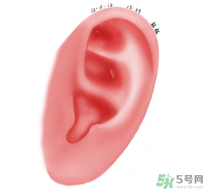 耳石脫落導(dǎo)致的眩暈怎么辦？耳石癥暈眩能自愈嗎？