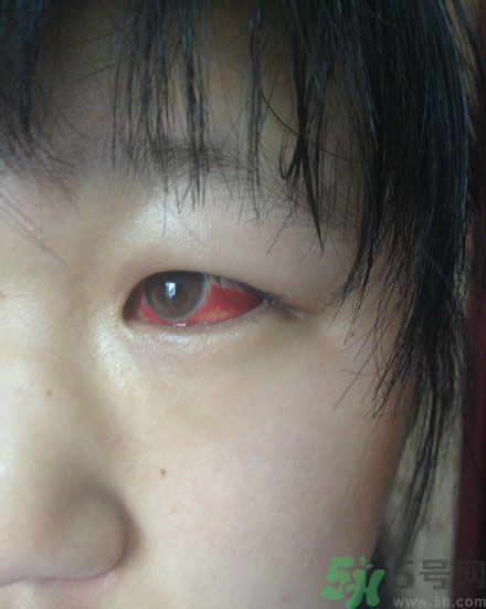 初中生全體甲醛中毒是怎么回事？初中生全體甲醛中毒是哪個學(xué)校？