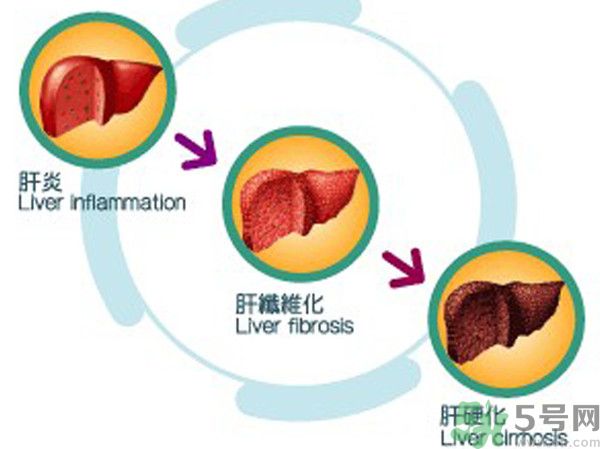在外面吃飯會(huì)得乙肝嗎？在食堂吃飯會(huì)得乙肝嗎？