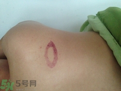 種草莓吻痕是什么意思？吻痕是怎么弄出來的？