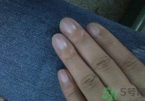 指甲發(fā)紫是什么原因？指甲發(fā)紫是怎么回事？