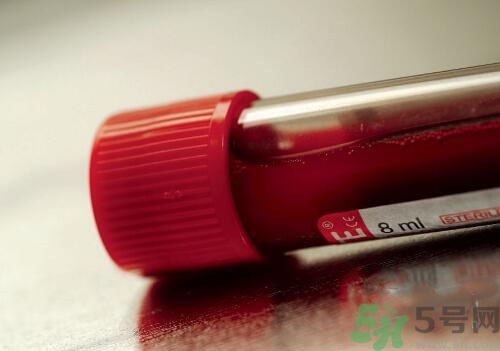 獻(xiàn)血后可以洗澡嗎？抽血后可以洗澡嗎？