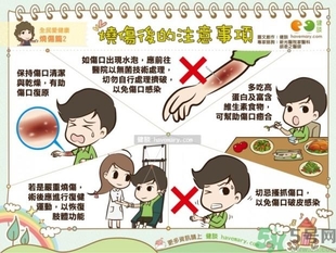 手被油燙傷了怎么處理？手被油燙起泡了怎么辦？