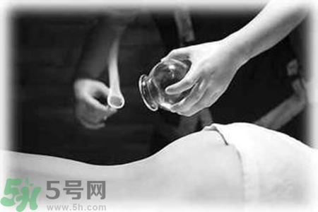 大暑可以拔罐嗎？大暑拔罐好不好？