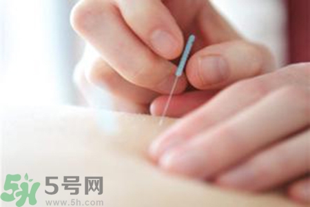 大暑可以針灸嗎？大暑針灸好不好？