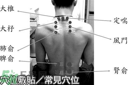 經(jīng)期可以貼三伏貼嗎？來月經(jīng)可以貼三伏貼嗎？