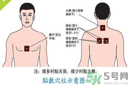 三伏貼能治頸椎病嗎？頸椎病三伏貼穴位