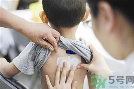 三伏貼能治頸椎病嗎？頸椎病三伏貼穴位