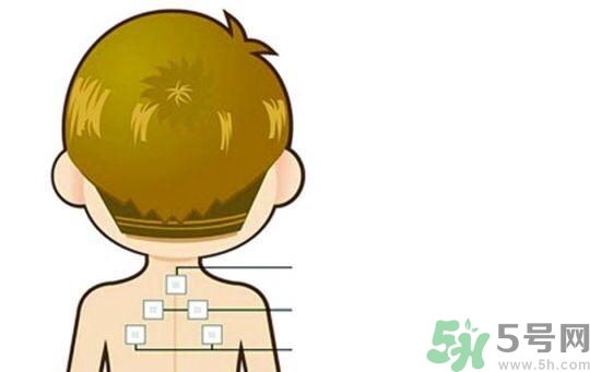 三伏貼可以去濕氣嗎？三伏貼去濕氣貼哪里？