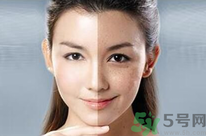 干性皮膚用什么洗面奶？干性皮膚該怎么保養(yǎng)？
