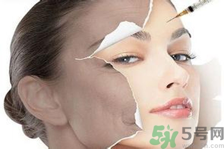 美白針效果怎么樣？美白針有副作用嗎？