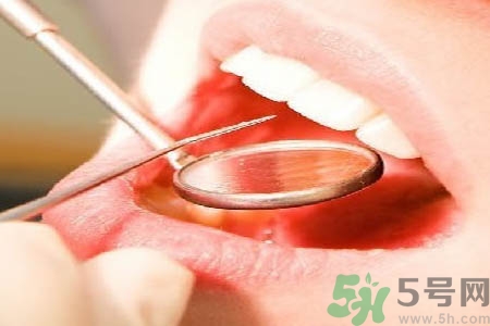 冷光美白牙齒是什么？冷光美白牙齒的好處有哪些？