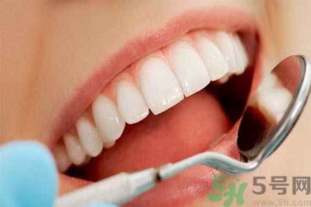 冷光美白牙齒的價(jià)格是多少？做冷光美白牙齒需要多少錢(qián)？