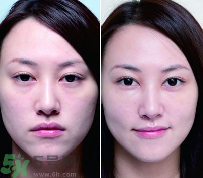 臥蠶是什么？臥蠶是眼袋嗎？