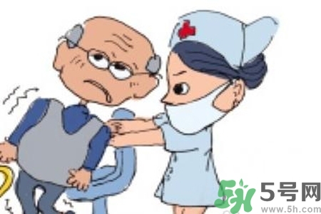 癲癇的典型癥狀有哪些？癲癇是什么？