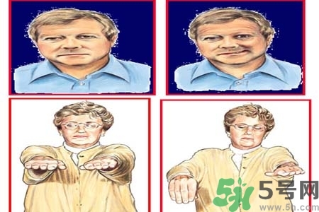 腦中風(fēng)是什么？腦中風(fēng)的癥狀？