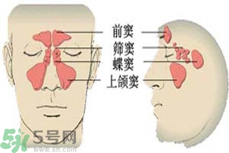 鼻竇炎是什么？鼻竇炎的癥狀有哪些？