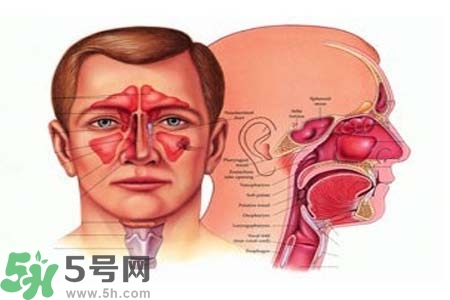 鼻竇炎的高發(fā)人群？如何預防鼻竇炎？
