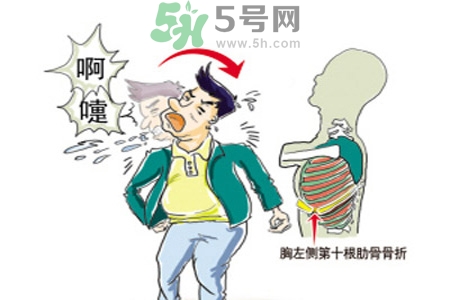 過敏性鼻炎是什么？過敏性鼻炎的癥狀有哪些？