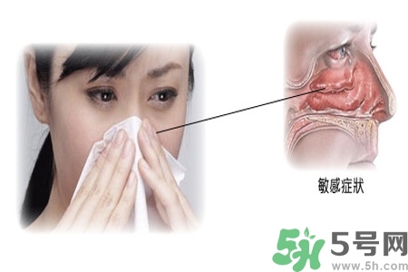 過敏性鼻炎的高發(fā)人群有哪些？如何預防過敏性鼻炎？