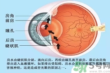 青光眼是什么？青光眼癥狀有什么？