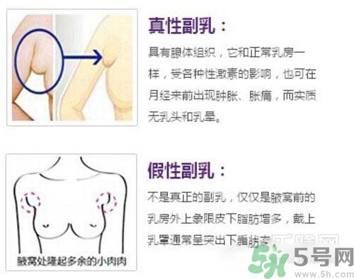 副乳是什么？副乳的危害