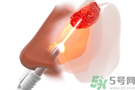 鼻咽癌的日常措施是什么？鼻咽癌注意的飲食有哪些？