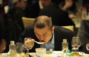 男人禿頂會遺傳嗎？男人禿頂是腎虛嗎？