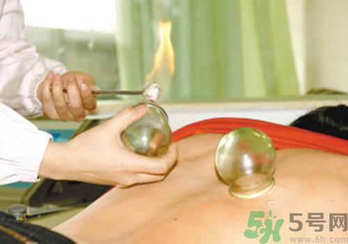 拔火罐和拔氣罐哪個(gè)好？拔火罐和拔氣罐的區(qū)別