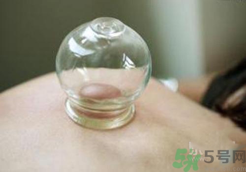 拔火罐和拔氣罐哪個(gè)好？拔火罐和拔氣罐的區(qū)別