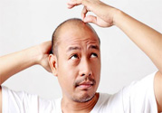 脫發(fā)的高發(fā)人群有哪些？如何預(yù)防脫發(fā)？