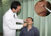 鼻咽癌的發(fā)病因素是什么？鼻咽癌的并發(fā)癥有哪些？