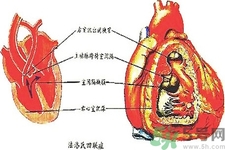 先天性心臟病可以用藥物治療嗎？