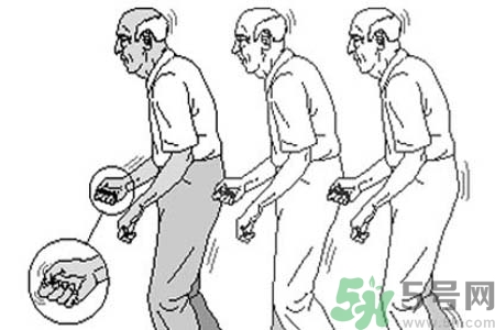 帕金森要注意哪些措施？帕金森的飲食需注意什么？