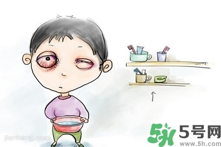 寶寶為什么會(huì)感染紅眼?。繉殞毣技t眼病如何治療？