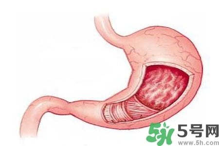 急性腸胃炎哪些食物不可以吃？急性腸胃炎不能吃的水果有？