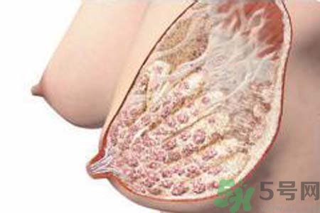 乳腺增生可以懷孕嗎？如何預防乳腺增生？