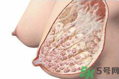 乳腺增生治療方法是什么？乳腺增生的檢查方法有哪些？