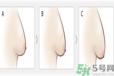 如何預(yù)防胸部松弛？吃什么能使胸部挺拔？