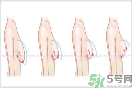 如何預(yù)防胸部松弛？吃什么能使胸部挺拔？