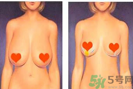 如何預(yù)防胸部松弛？吃什么能使胸部挺拔？