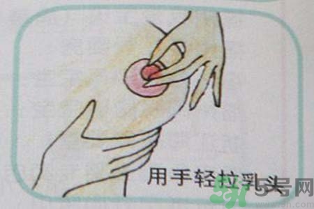 乳頭內(nèi)陷怎么回事？乳頭內(nèi)陷的原因是什么？
